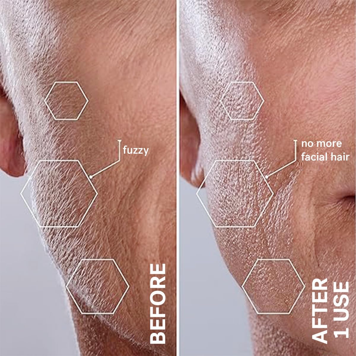 Rasoio Dermaplaning Pro+ con LED